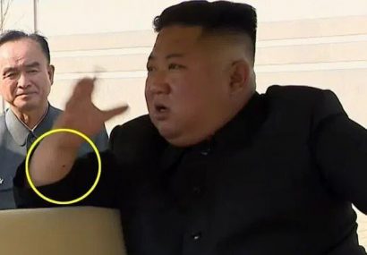 جای سوزن روی مچ رهبر کره شمالی / چه بلایی سر کیم جونگ اون آمده است؟