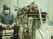 عکس جالبی از پزشک و دستیار در اتاق عمل پس از ۲۳ ساعت جراحی پیوند قلب